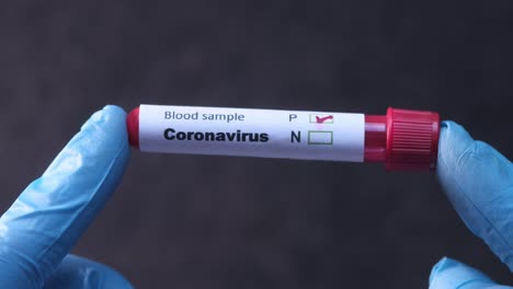 coronavirus blood sample test