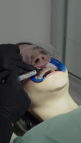 dentist applies gel for teeth whitening procedure, close-up, vertical