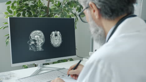 doctor reviewing mri brain scan