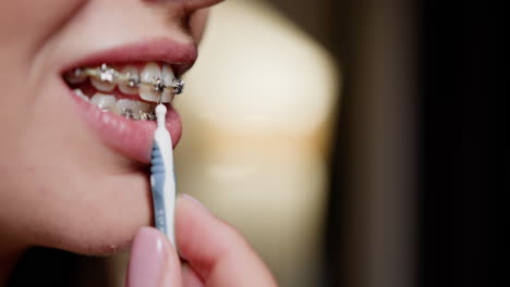 mujer limpiando los dientes con aparatos dentales