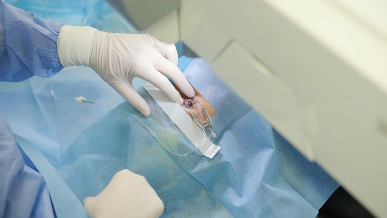 corrección de la visión con láser. un paciente y un equipo de cirujanos en la sala de operaciones durante una cirugía oftalmológica