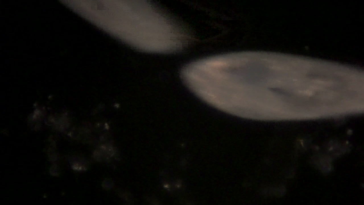 단세포 유기체인 짚신벌레의 현미경 사진