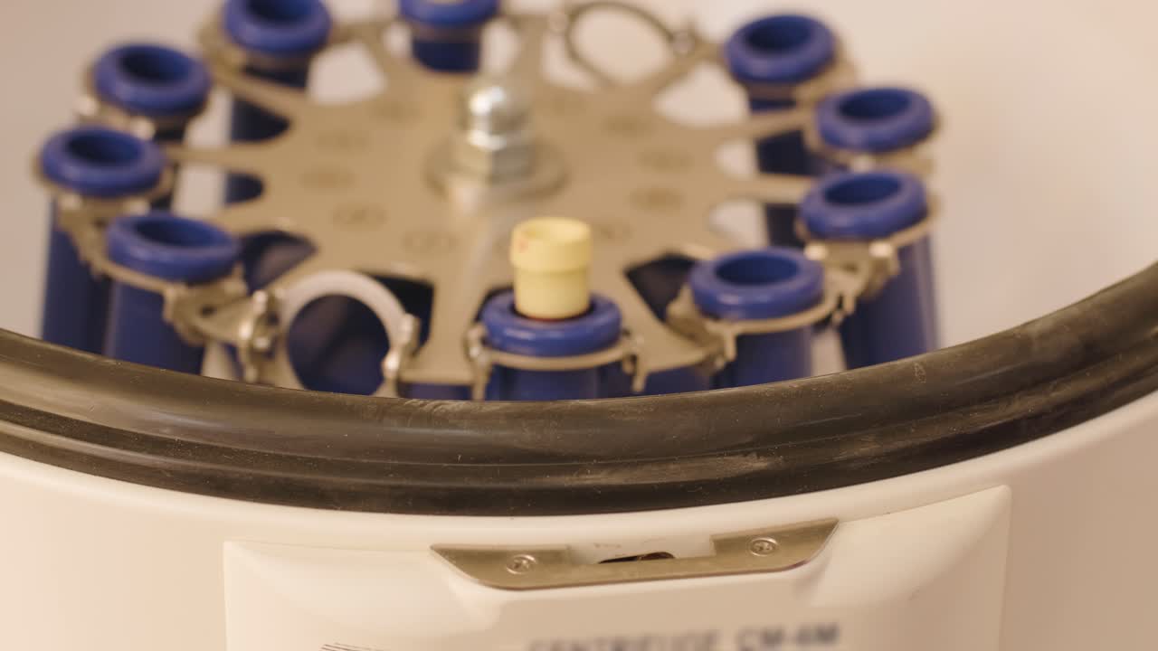 혈소판이 풍부한 플라즈마 준비: 손에 혈액을 가진 튜브, 원심분리기, 배경