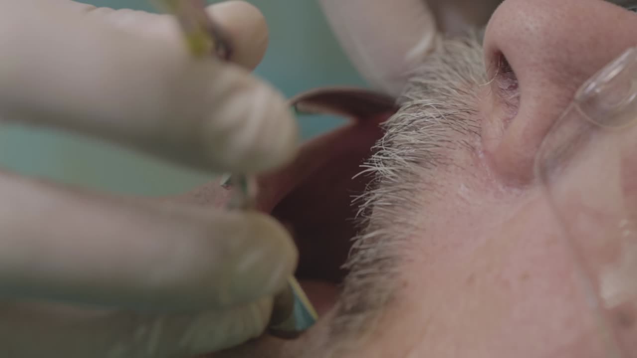Close-up view of a dentist examining a patient's teeth