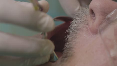 close-up view of a dentist examining a patient's teeth