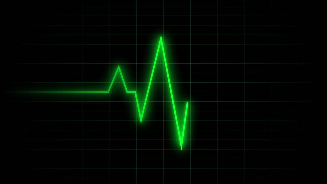 Linea verde del battito cardiaco su monitor digitale.