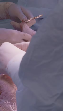 medical professional in surgical gloves performing procedure in a sterile environment with focus on hands