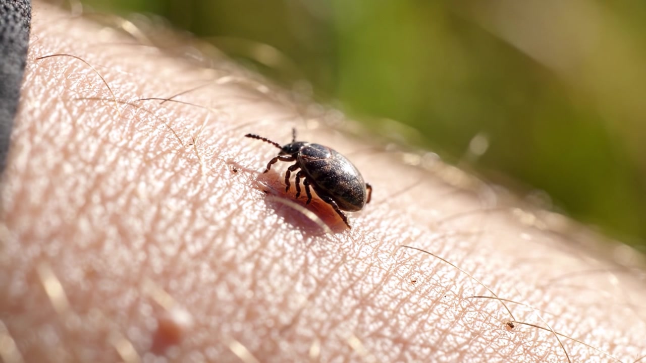 Una Exploración Detallada de una Garrapata en la Piel Humana, Observando los Fascinantes Detalles de Este Pequeño Parásito y Su Interacción con el Entorno del Huésped