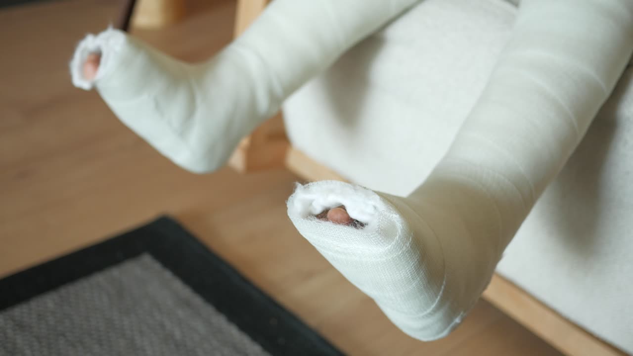 niño con un yeso en la pierna