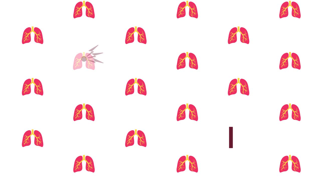 animación del patrón de propagación de la infección por el virus corona