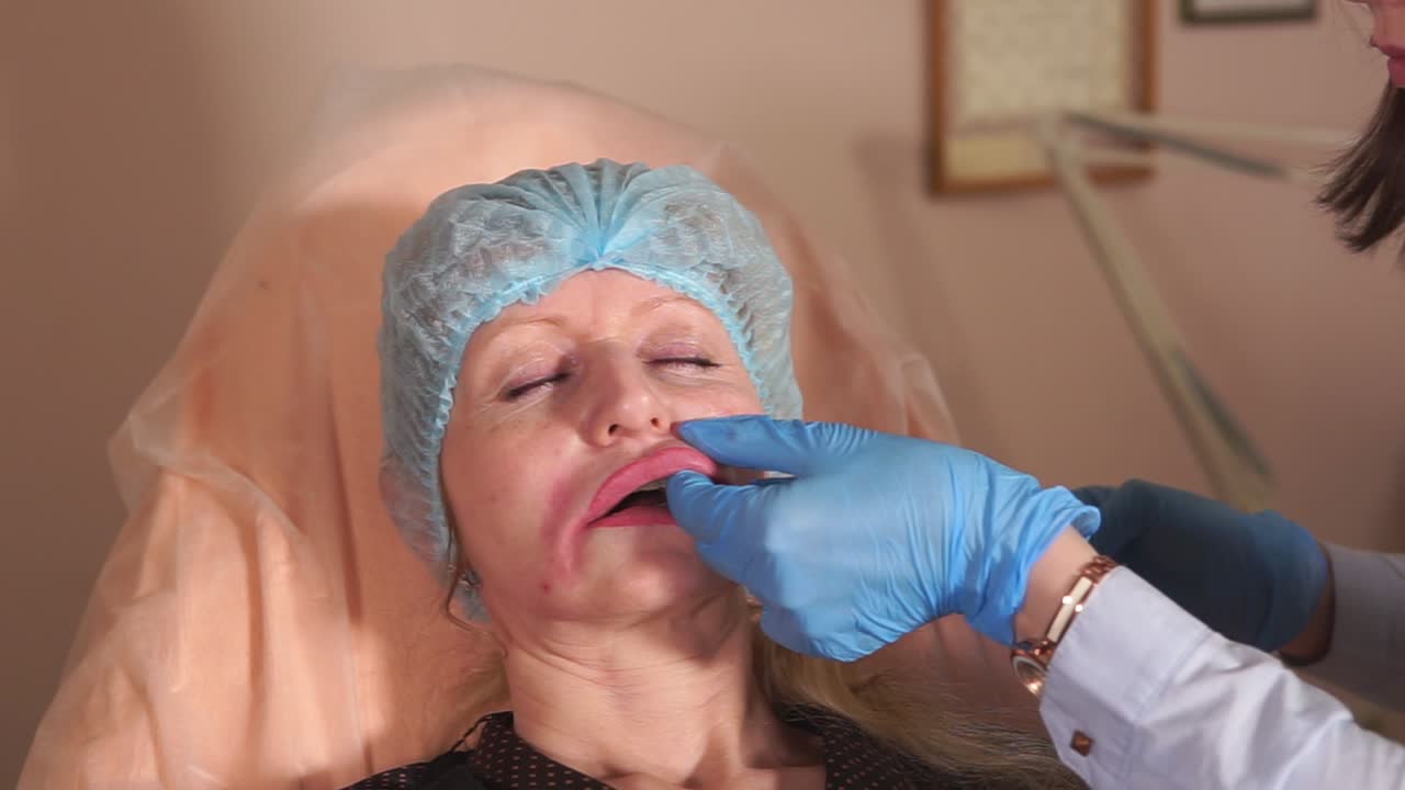 Procedure for læbeforstørrelse