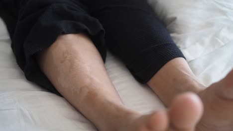 skin patches on legs