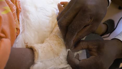 una vista de cerca de un hombre que usa una hoja de afeitar para cortar un yeso del brazo de un niño pequeño