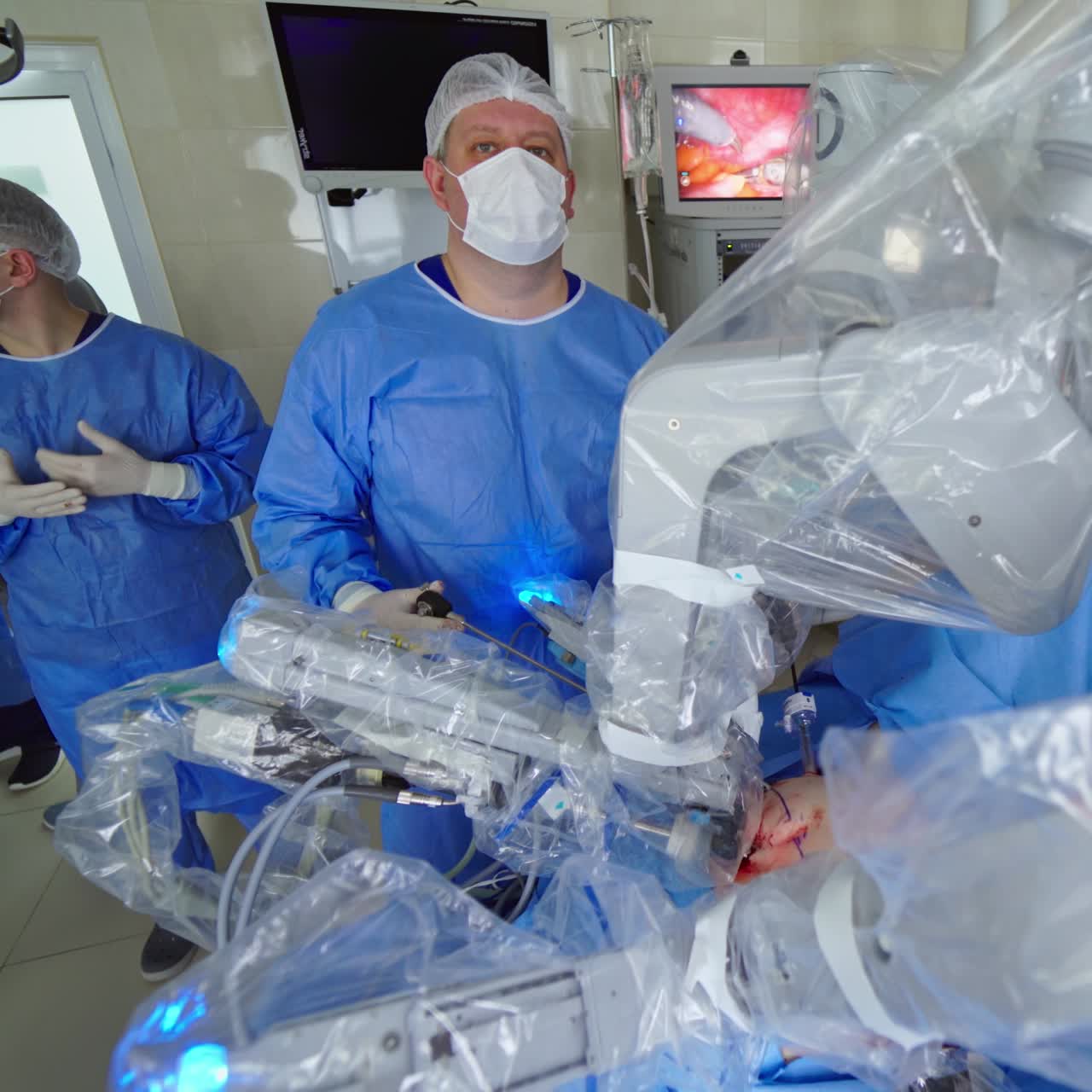 Surgery with robotic equipment. Medical team observing the operation of a medical robot in modern clinic. Minimally invasive robotic operation