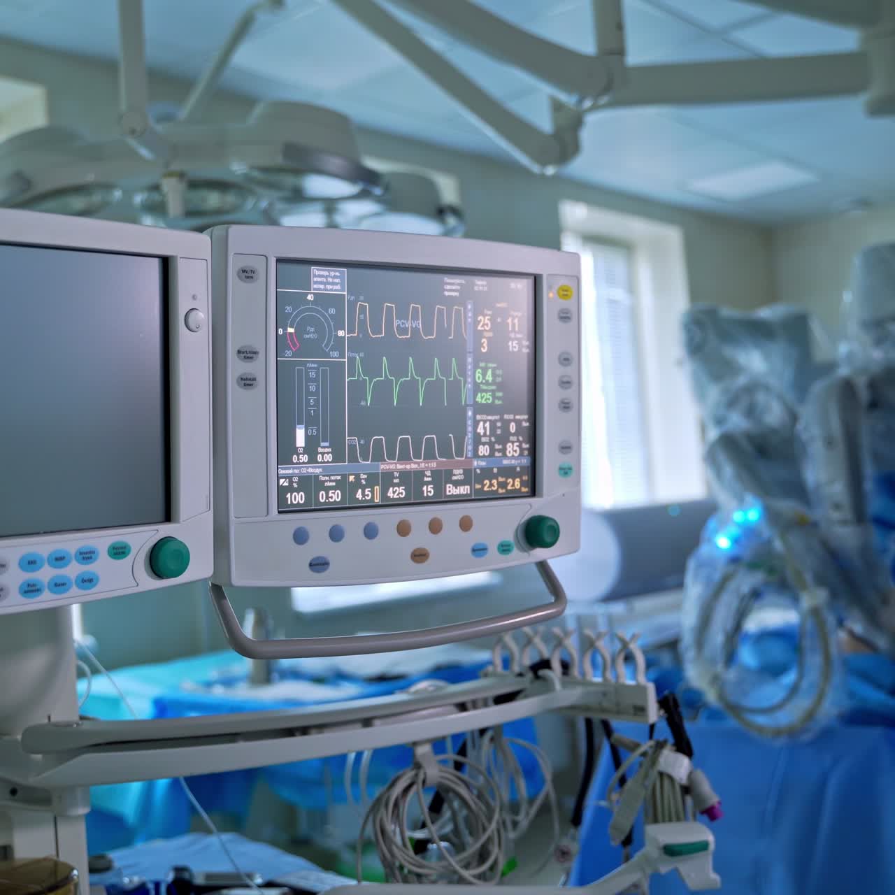 Real medical monitor displays vital signs during surgery. Graphics of electrical activity of patient heart beat and blood pressure