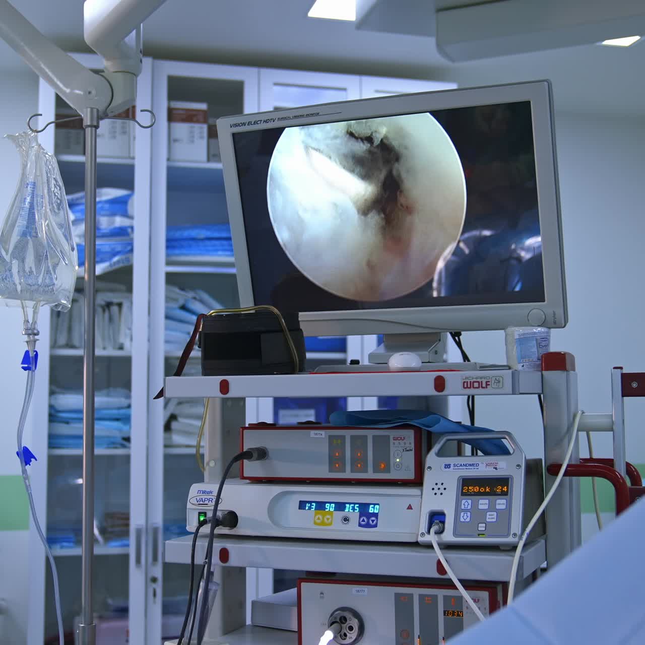 In surgery. Medical team performing operation in hospital operating theater. Working with surgical instruments