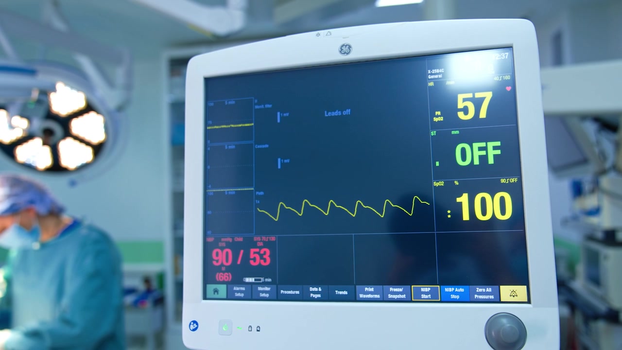 Segni vitali del paziente sul monitor del ventilatore polmonare. Una chirurga lavora sullo sfondo, in sfocatura.