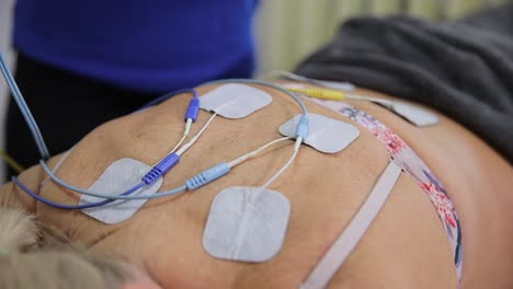 a therapeutic treatment session conducted in a professional medical facility or clinic. a closeup view of a patient undergoing electrotherapy treatment on their back while electrodes are attached
