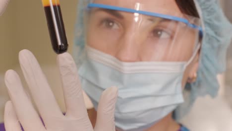 preparación de plasma rico en plaquetas. tubo con sangre en las manos.