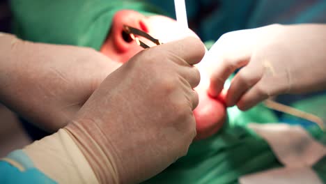 dental surgery procedure