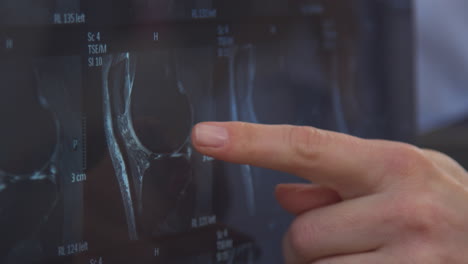 close up of woman doctor or gp in office pointing at ct or mri scan