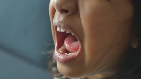 child with mouth wide open