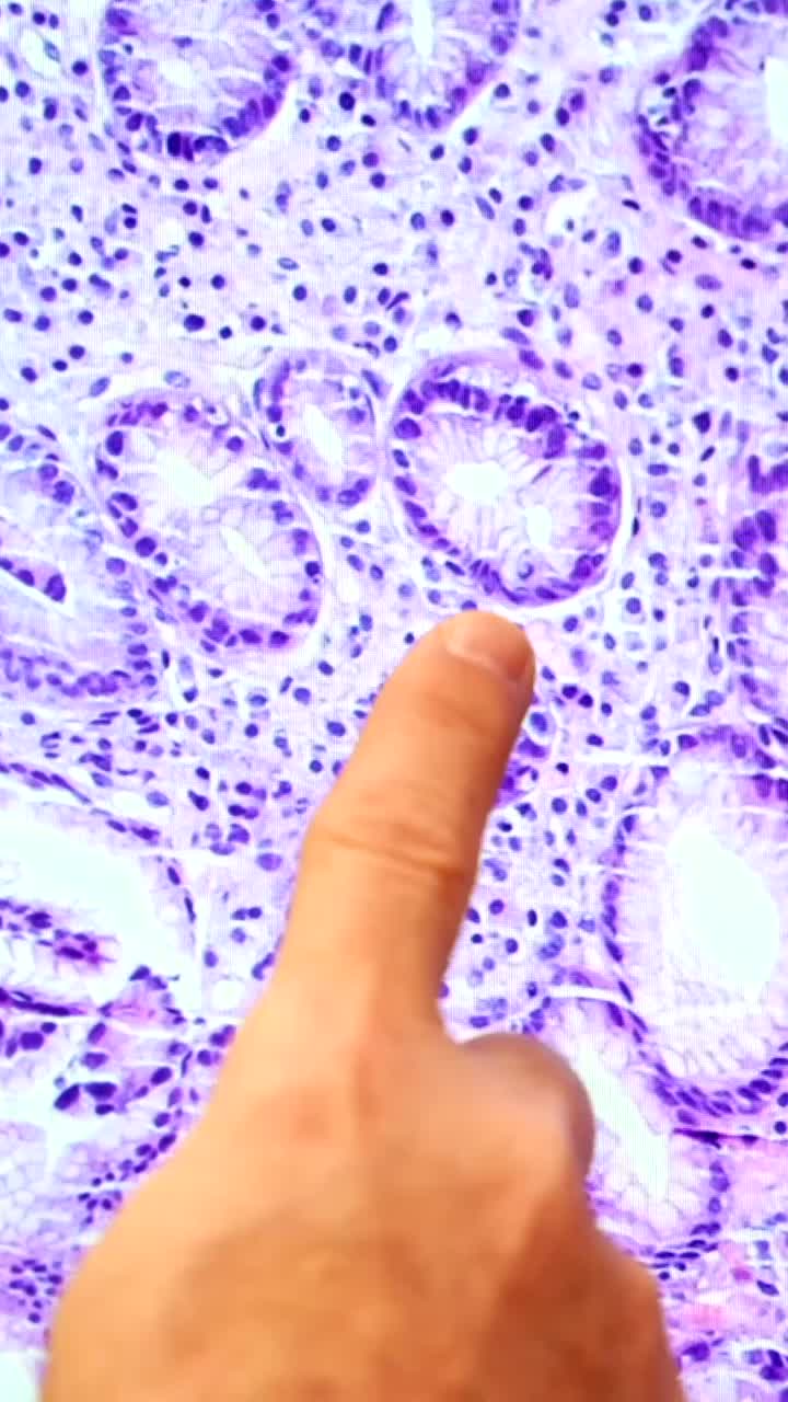 Microscopic view of human tissue