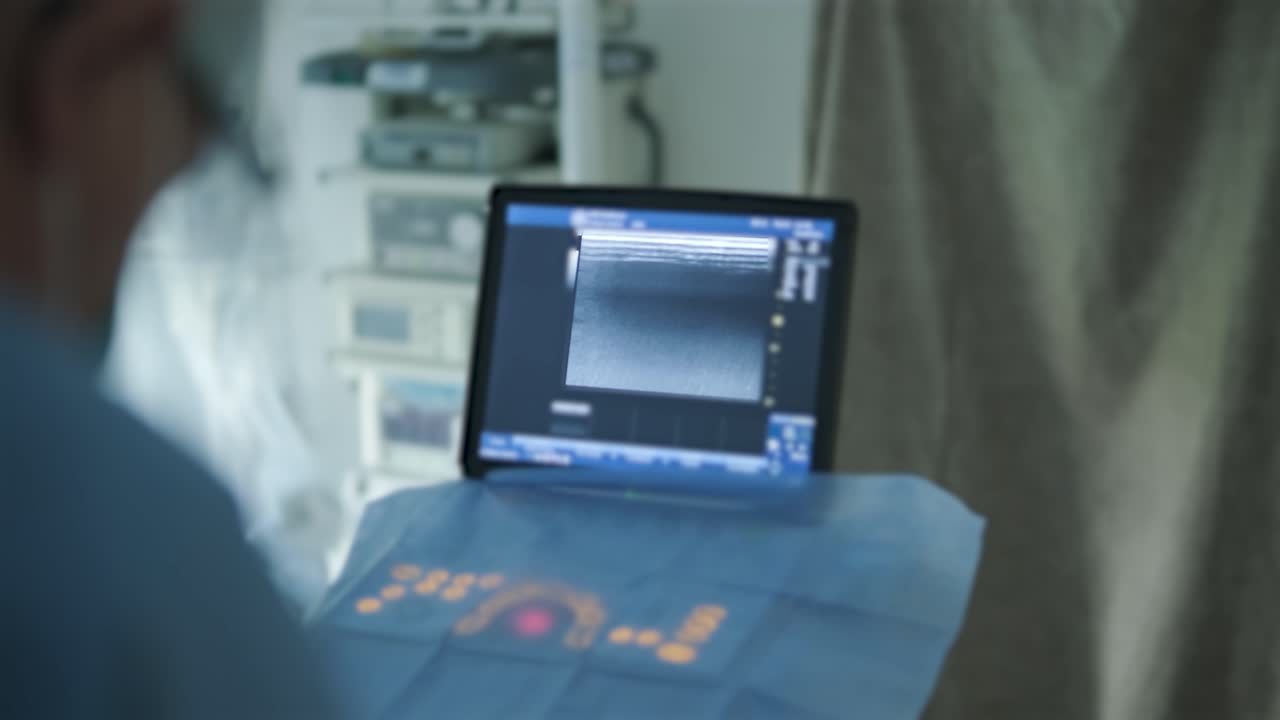 herida de úlcera en la pierna en el tratamiento de venas varicosas en el procedimiento de flebología. unión de venas con pegamento biológico