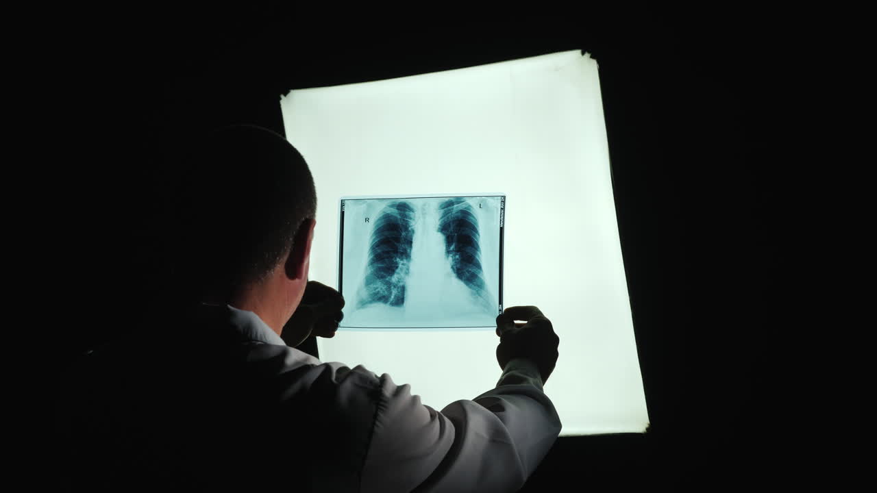 el médico examina la radiografía de los pulmones 1