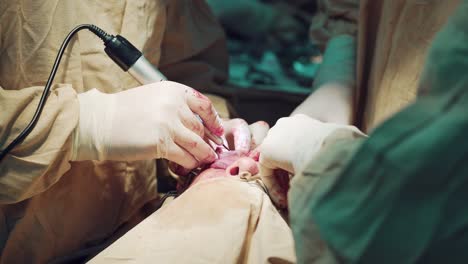 in surgery. gloves of surgeons are bloodied during the operation of the patient on the face. close-up