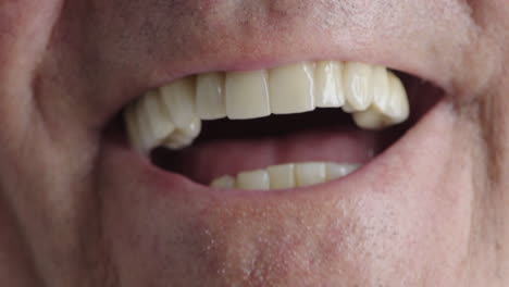 close-up-of-elderly-man-mouth-laughing-healthy-teeth