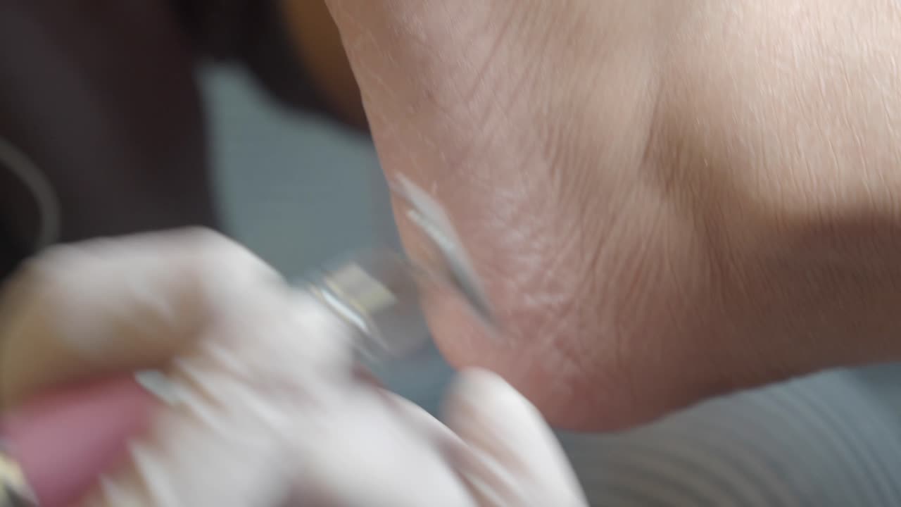 Primo piano di un trattamento professionale di pedicure sul tallone di un piede
