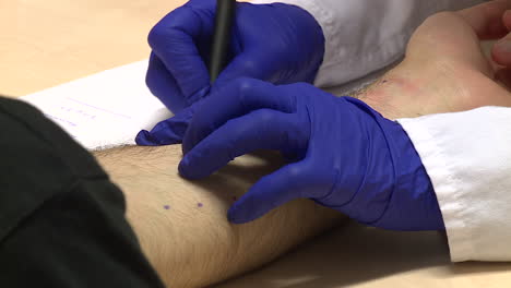 allergy skin test