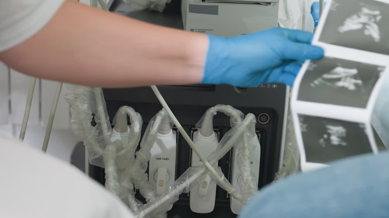 close up of female radiologist in gloves carefully pulling out printed ultrasound images from machine while pointing in explanation of scan details during medical consultation in clinical room