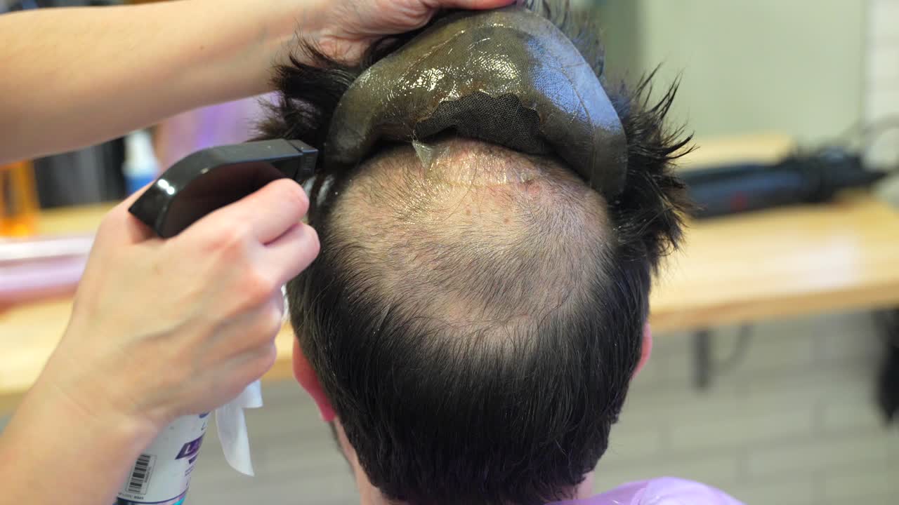 Hairpiece application for hair loss