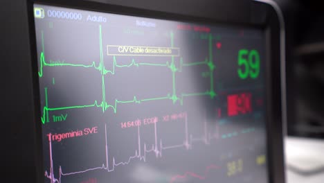 heart rate monitor with graphics and numbers in hospital