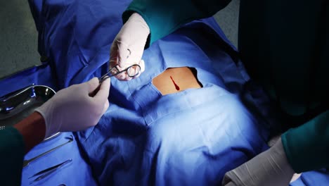 cirujanos que realizan una operación en la sala de operaciones