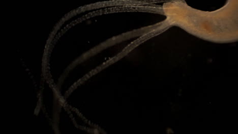 Microscopic-footage-of-Hydra