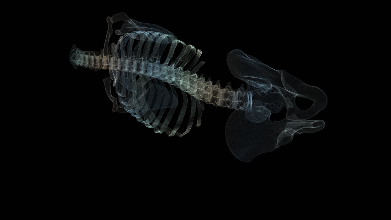 척추 디스크 헤르니아 진단을 위해 환자의 척추를 스캐닝하는 홀로그램의 미래 생의학 개념