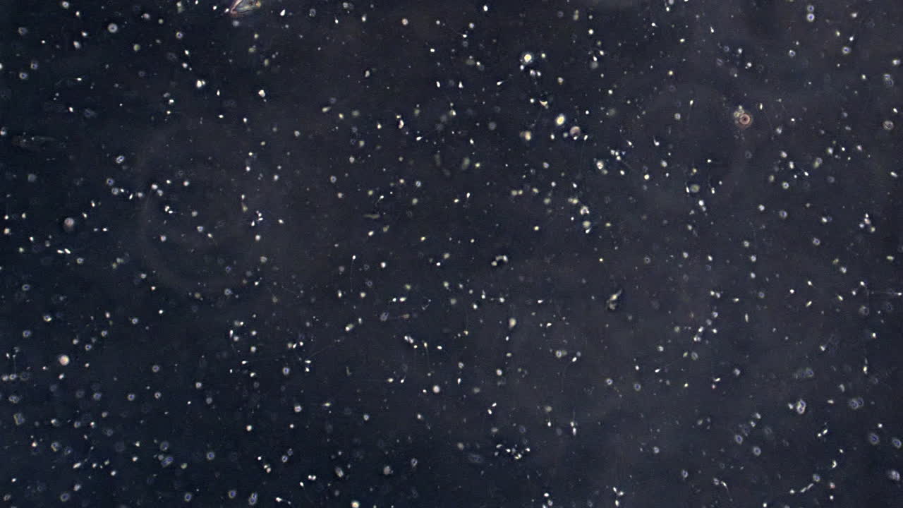 현미경은 수영하는 정자 세포를 보여주기 위해 초점을 맞추고 있습니다.