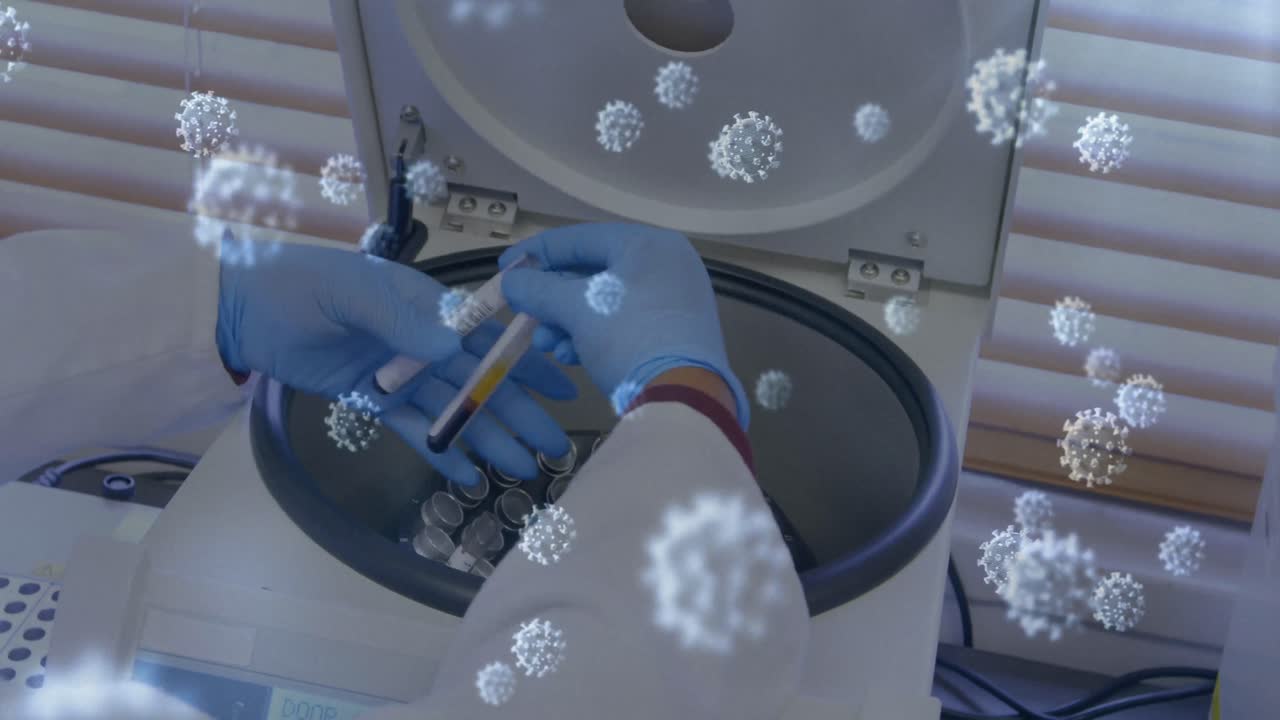 표본을 가져가는 여성 의사 위에 떠다니는 거대 코로나19 세포의 애니메이션