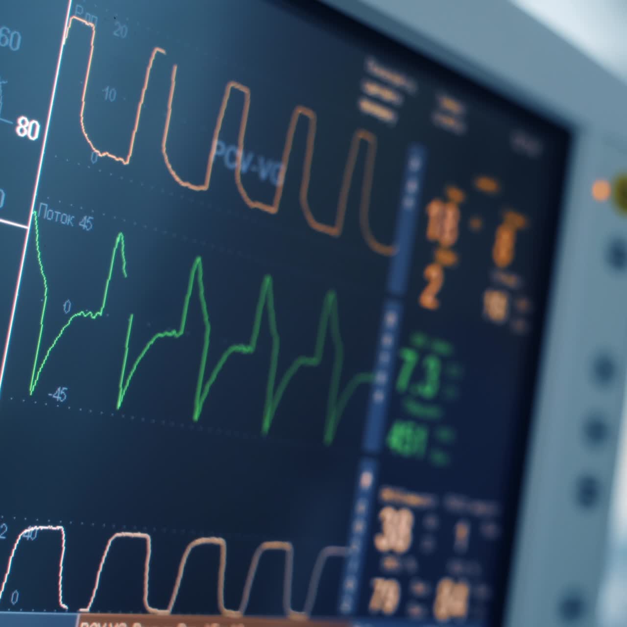 Real medical monitor displays vital signs during surgery. Graphics of electrical activity of patient heart beat and blood pressure. Close-up.