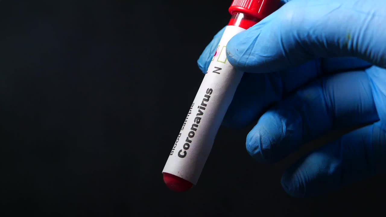 Coronavirus Blood Sample Test