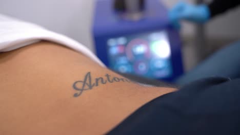 chica borrando tatuaje del nombre del ex novio, borrando o quitando