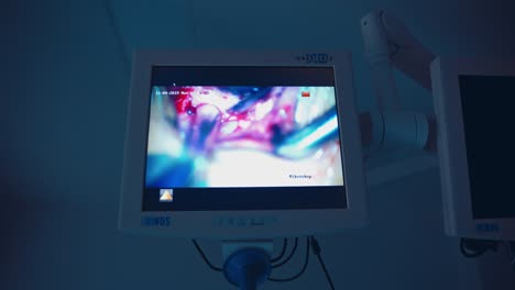 professional medical equipment. surgeon operating patient working with surgical laparoscopic instruments