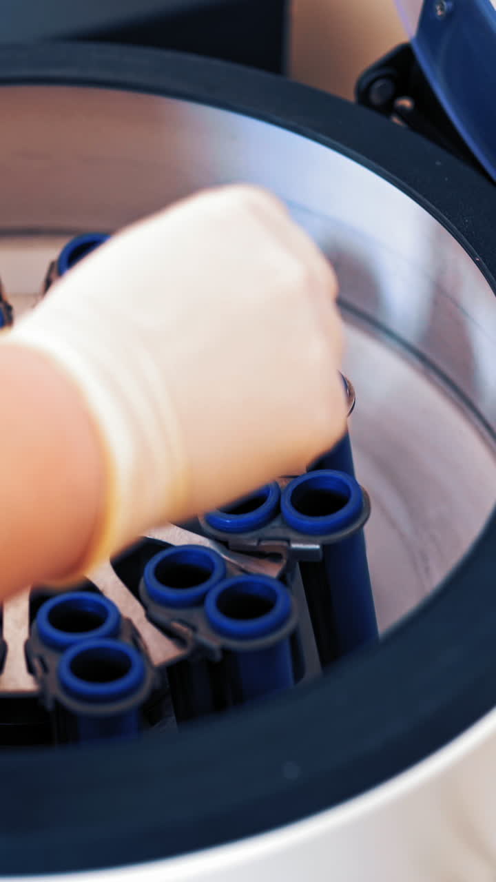 Female scientist loads some vials of liquid into a centrifuge in a laboratory. Close-up hands in protective gloves of a female placing blood samples in the special machine and switches it on. Vertical video
