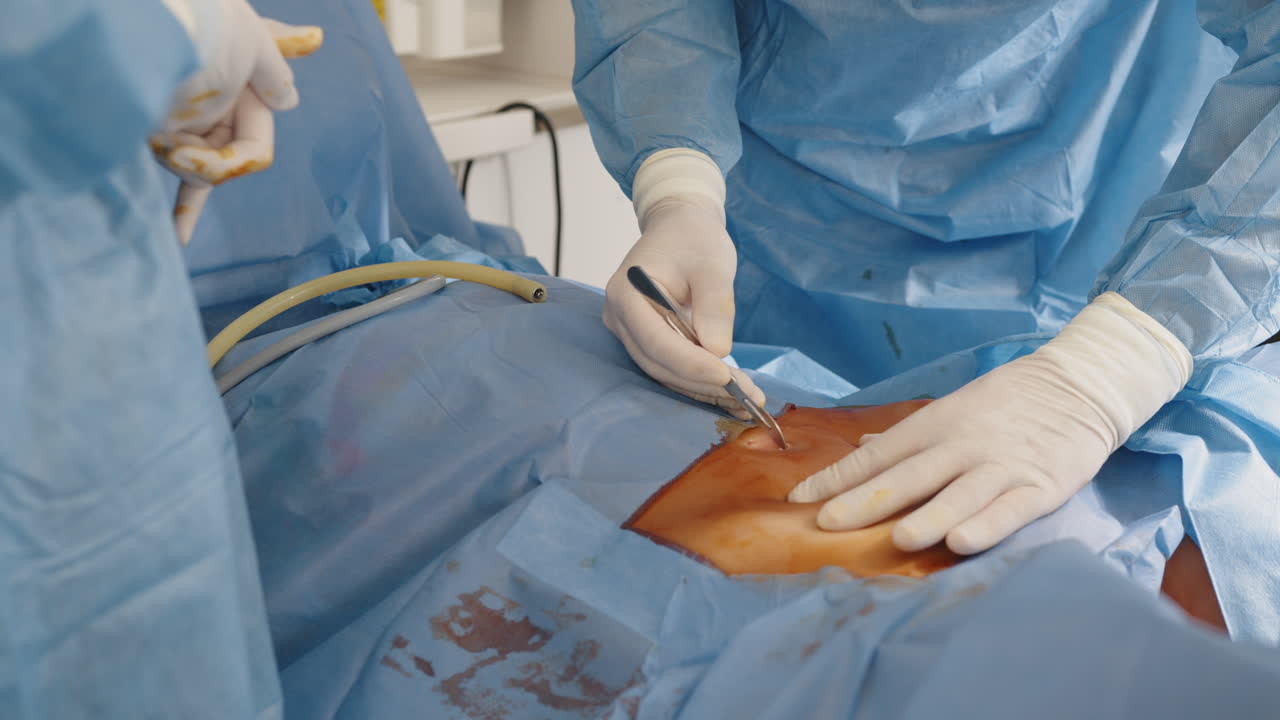 procedimiento quirúrgico en curso