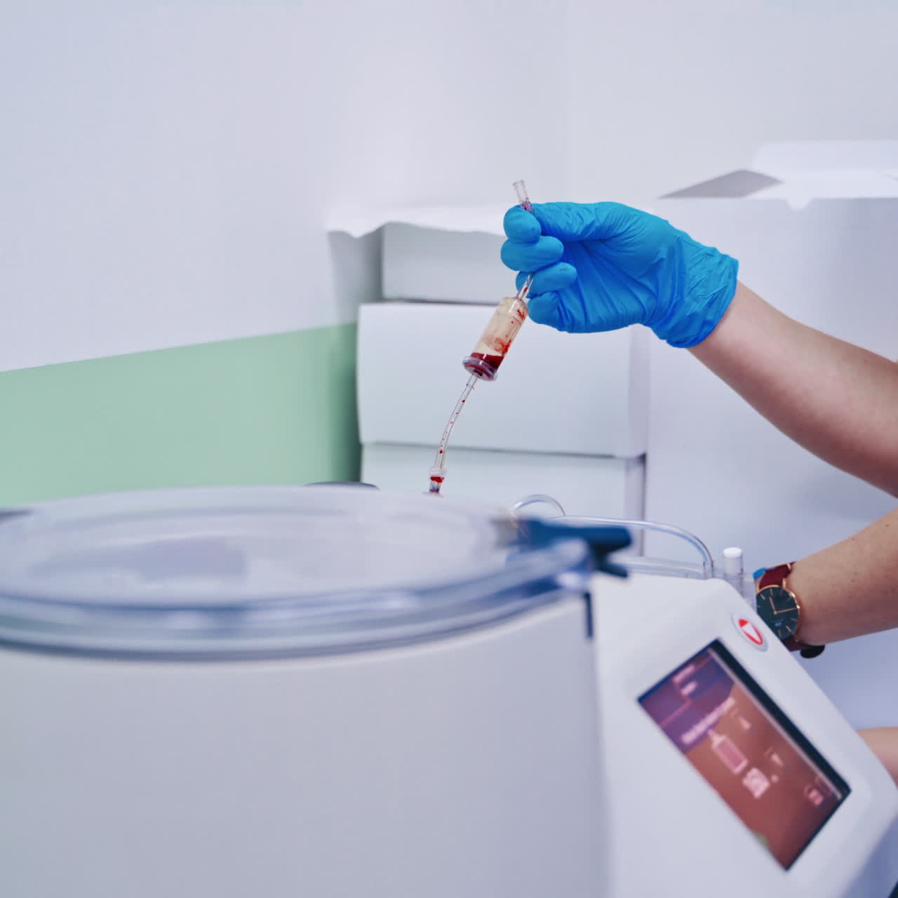 Stem cell therapy. Plasma in syringe. Centrifuge.