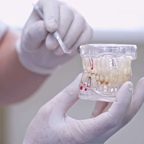 doctor shows on a plastic jaw sample or model different methods of teeth treatment. modern dental clinic background. health concept. white medical gloves on male doctor's hands.