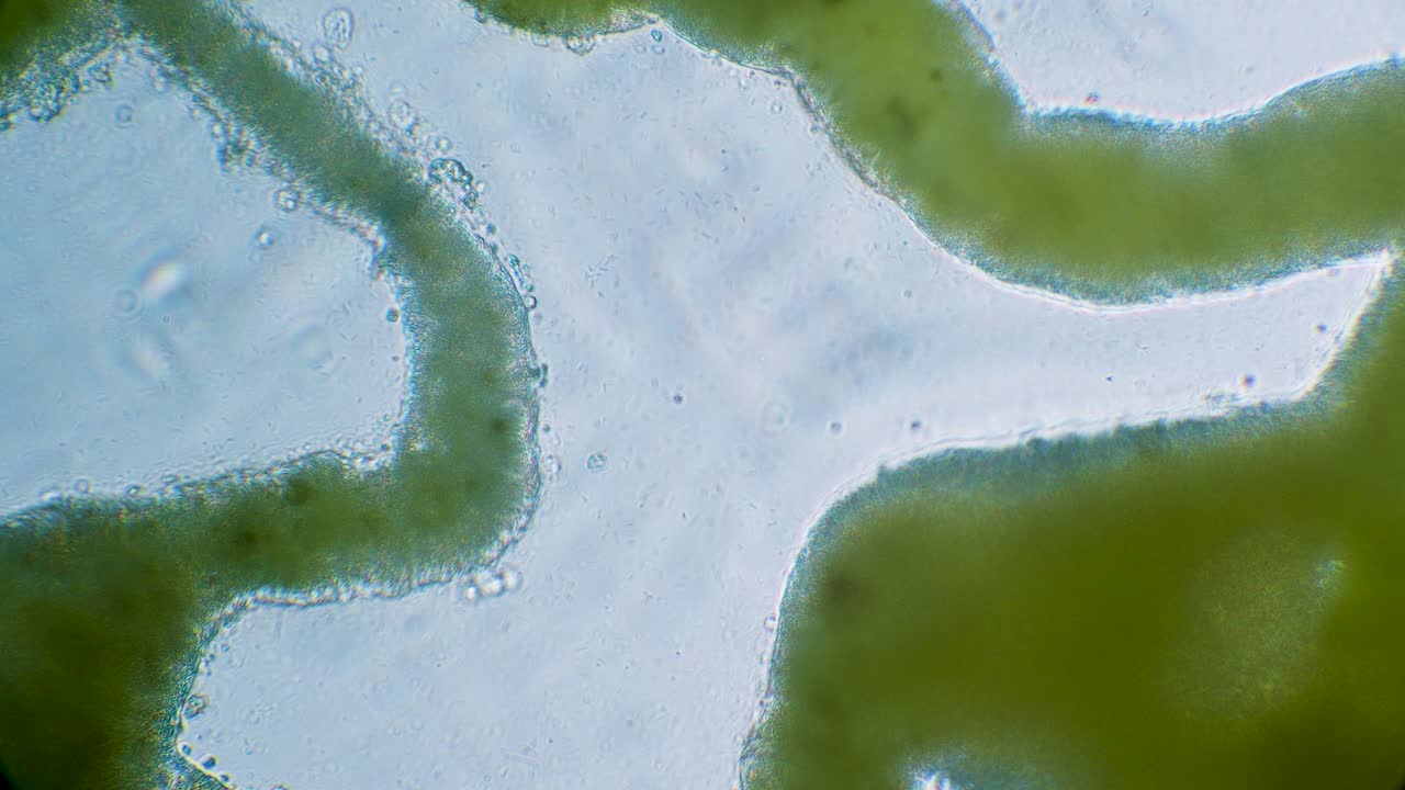 Slime mold plasmodium under microscope surrounded by bacteria